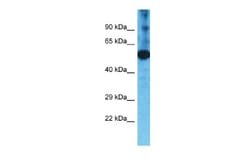 TMPRSS11F Rabbit anti-Human, Polyclonal, Novus Biologicals 0.1 mL | Buy Online | Novus Biologicals | Fisher Scientific